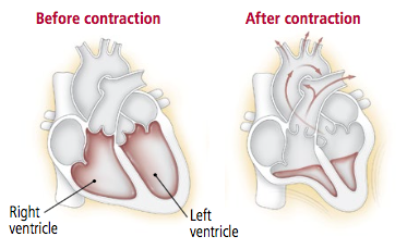 VHFC0011_What_is_ejection_fraction_image1.png