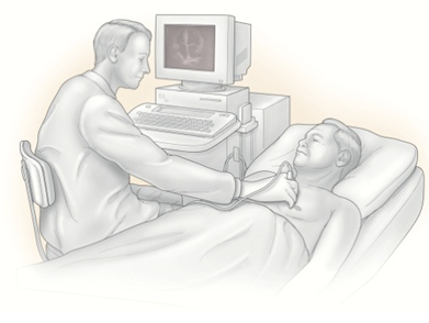 VHFC0022_What_is_an_echocardiogram_image1.png